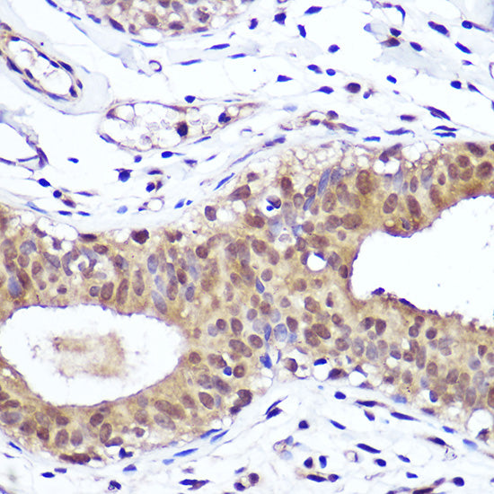 [KO Validated] PTEN Rabbit mAb