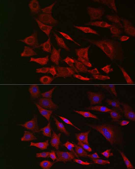 [KO Validated] PTEN Rabbit mAb