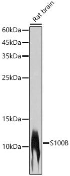 S100B Rabbit mAb
