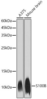 S100B Rabbit mAb
