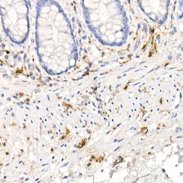 S100B Rabbit mAb