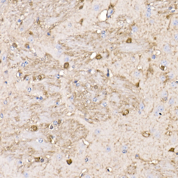 S100B Rabbit mAb