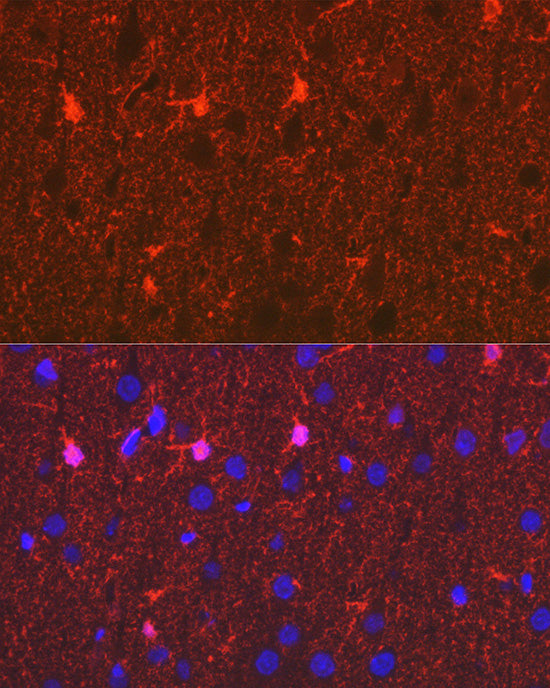 S100B Rabbit mAb