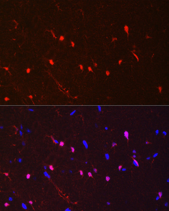 S100B Rabbit mAb