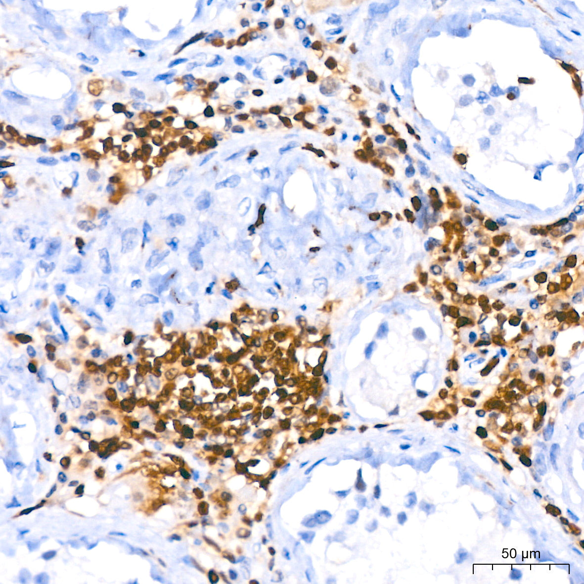 FSP1/S100A4 Rabbit mAb