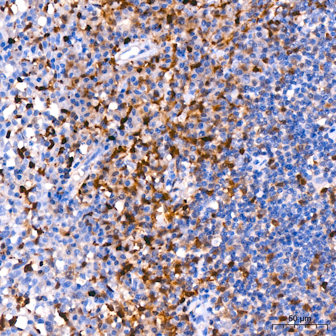 FSP1/S100A4 Rabbit mAb