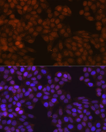 FSP1/S100A4 Rabbit mAb