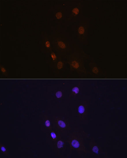 FSP1/S100A4 Rabbit mAb