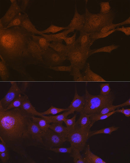 FSP1/S100A4 Rabbit mAb