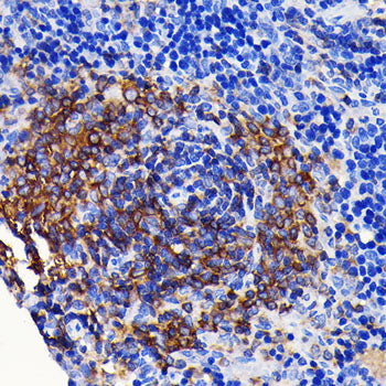 SHP1 Rabbit mAb