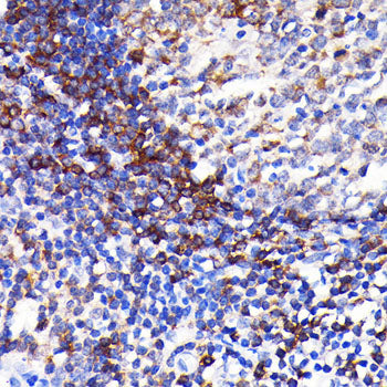 SHP1 Rabbit mAb