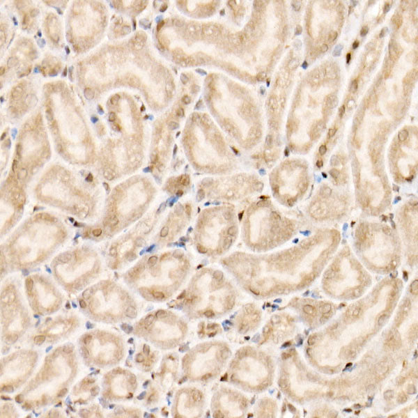 [KO Validated] Smad1 Rabbit mAb