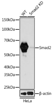 [KD Validated] Smad2 Rabbit mAb