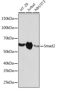 [KD Validated] Smad2 Rabbit mAb