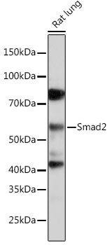 [KD Validated] Smad2 Rabbit mAb