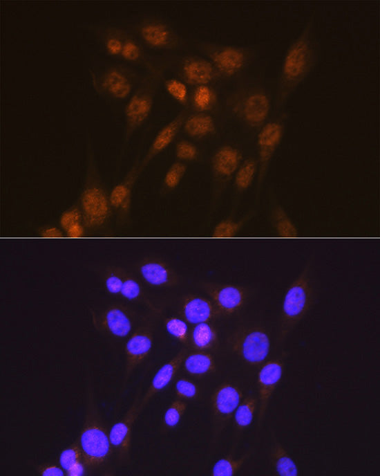 [KD Validated] Smad2 Rabbit mAb