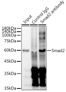 [KD Validated] Smad2 Rabbit mAb