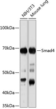 [KO Validated] Smad4 Rabbit mAb