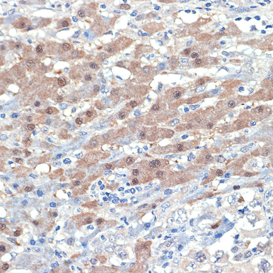 [KO Validated] Smad4 Rabbit mAb
