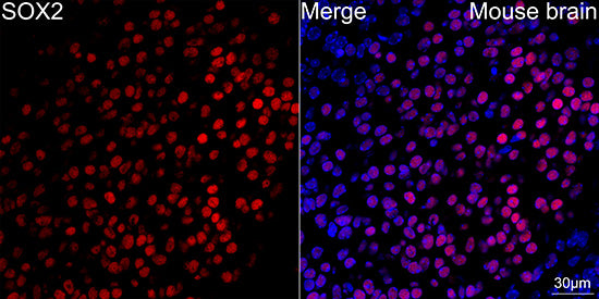 SOX2 Rabbit mAb