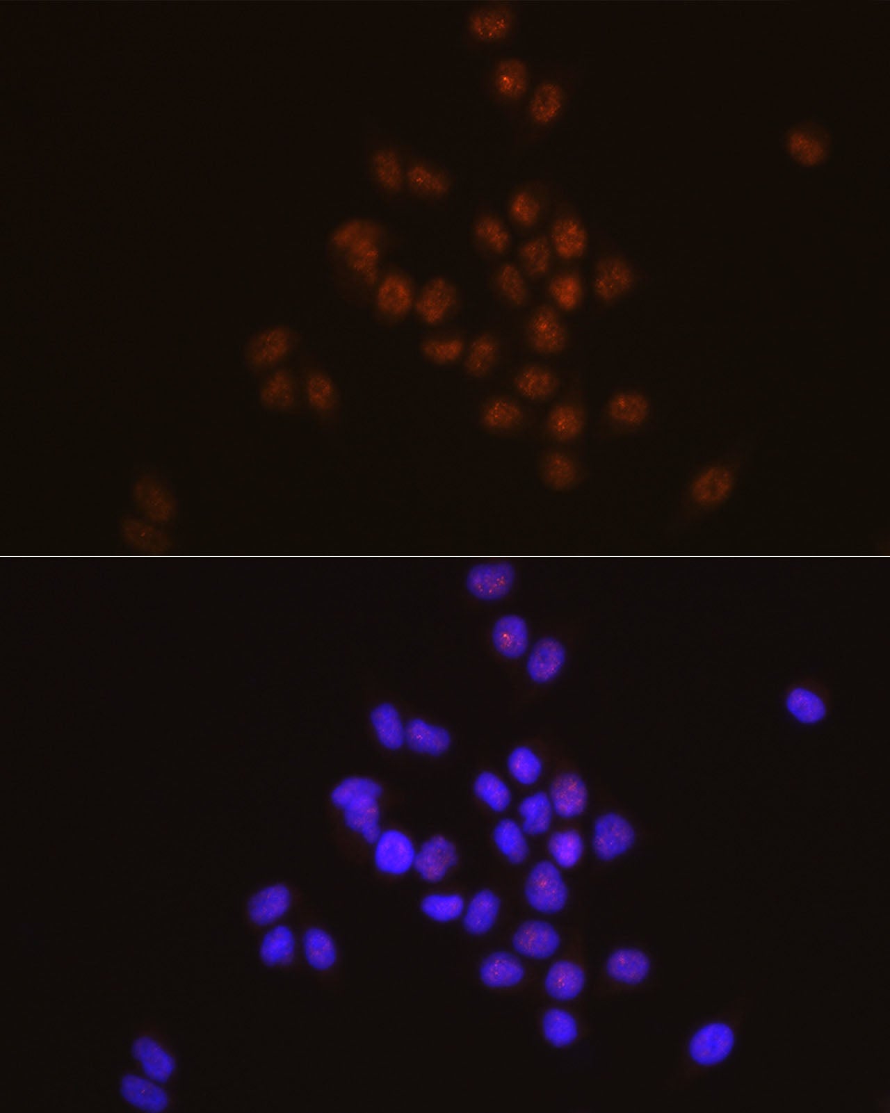 STAT6 Rabbit mAb