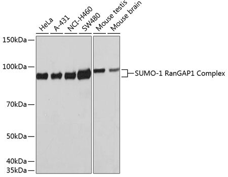 [KO Validated] SUMO1 Rabbit mAb