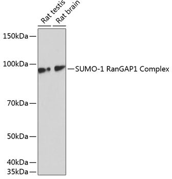 [KO Validated] SUMO1 Rabbit mAb