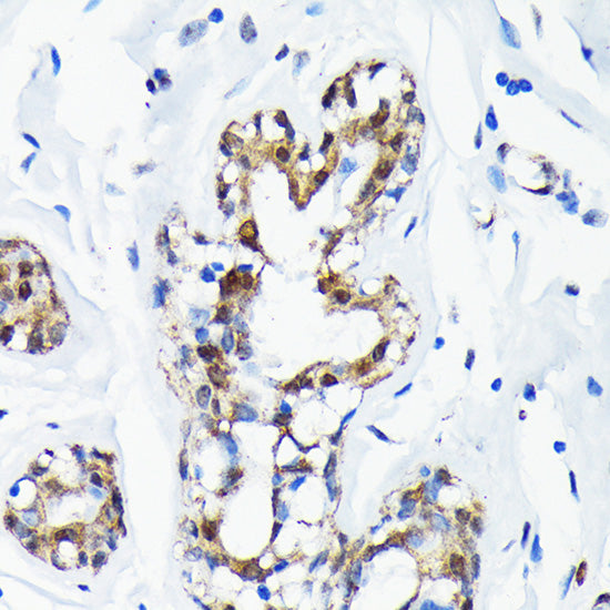 [KO Validated] SUMO1 Rabbit mAb