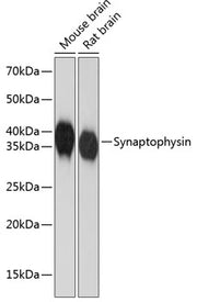 Synaptophysin Rabbit mAb
