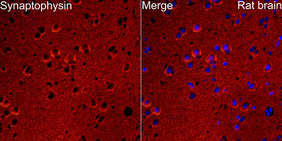 Synaptophysin Rabbit mAb