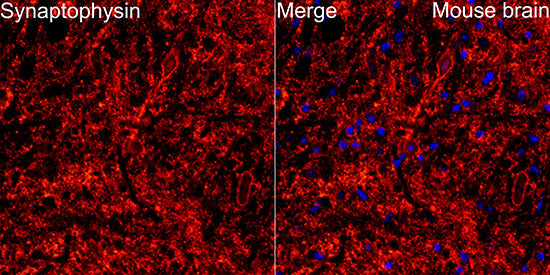 Synaptophysin Rabbit mAb