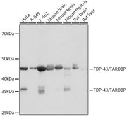 TDP-43/TARDBP Rabbit mAb