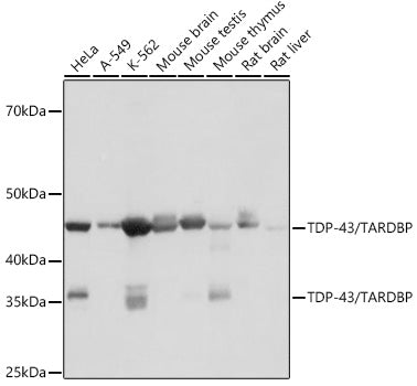 TDP-43/TARDBP Rabbit mAb