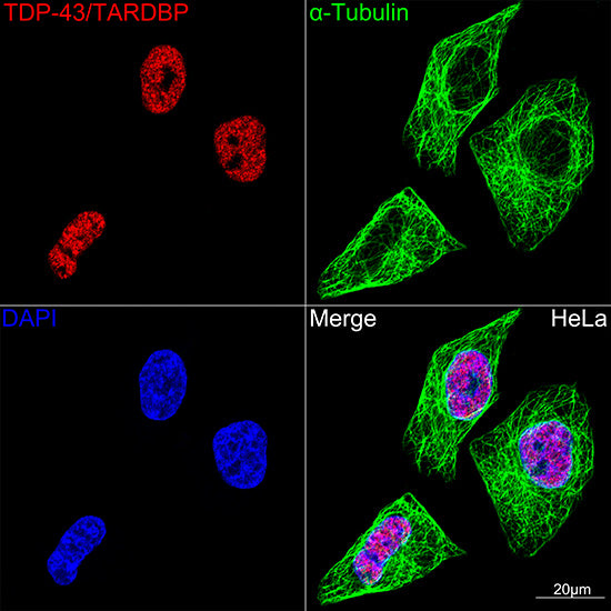TDP-43/TARDBP Rabbit mAb
