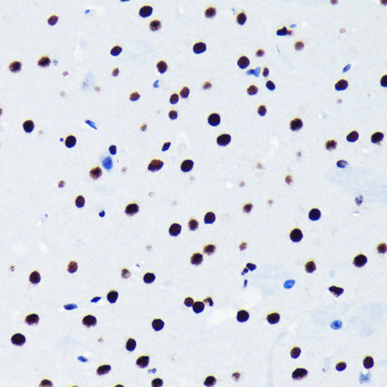 TDP-43/TARDBP Rabbit mAb