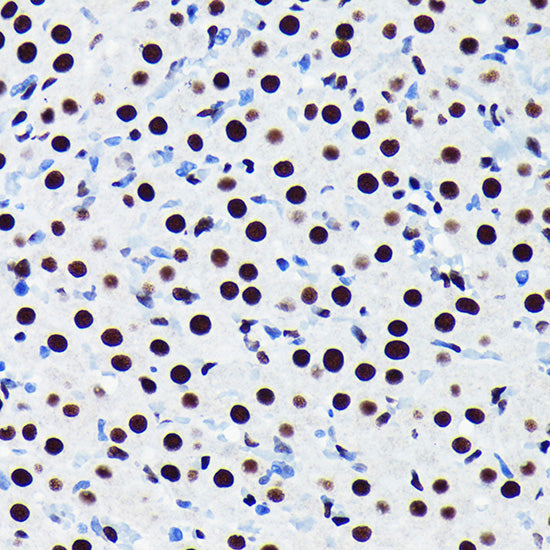 TDP-43/TARDBP Rabbit mAb