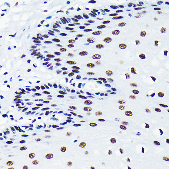 TDP-43/TARDBP Rabbit mAb