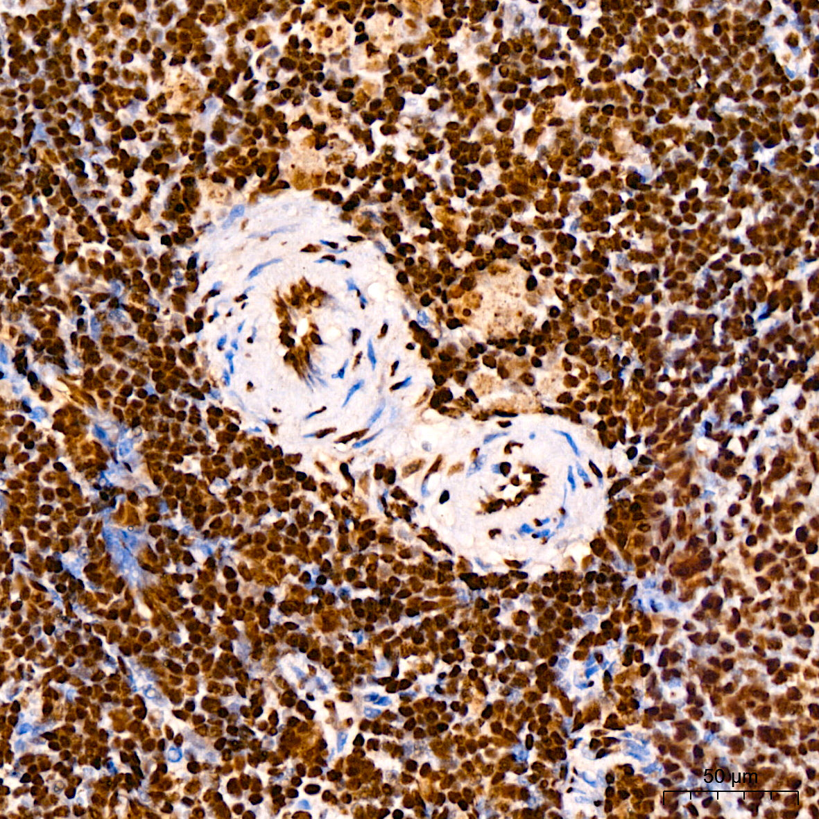 TDP-43/TARDBP Rabbit mAb