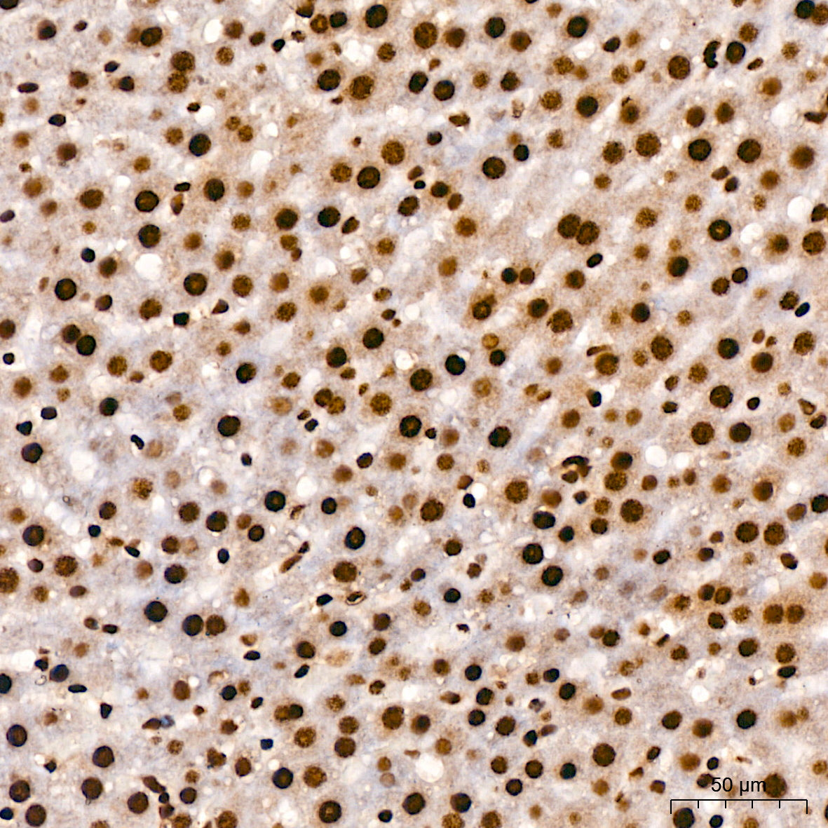 TDP-43/TARDBP Rabbit mAb