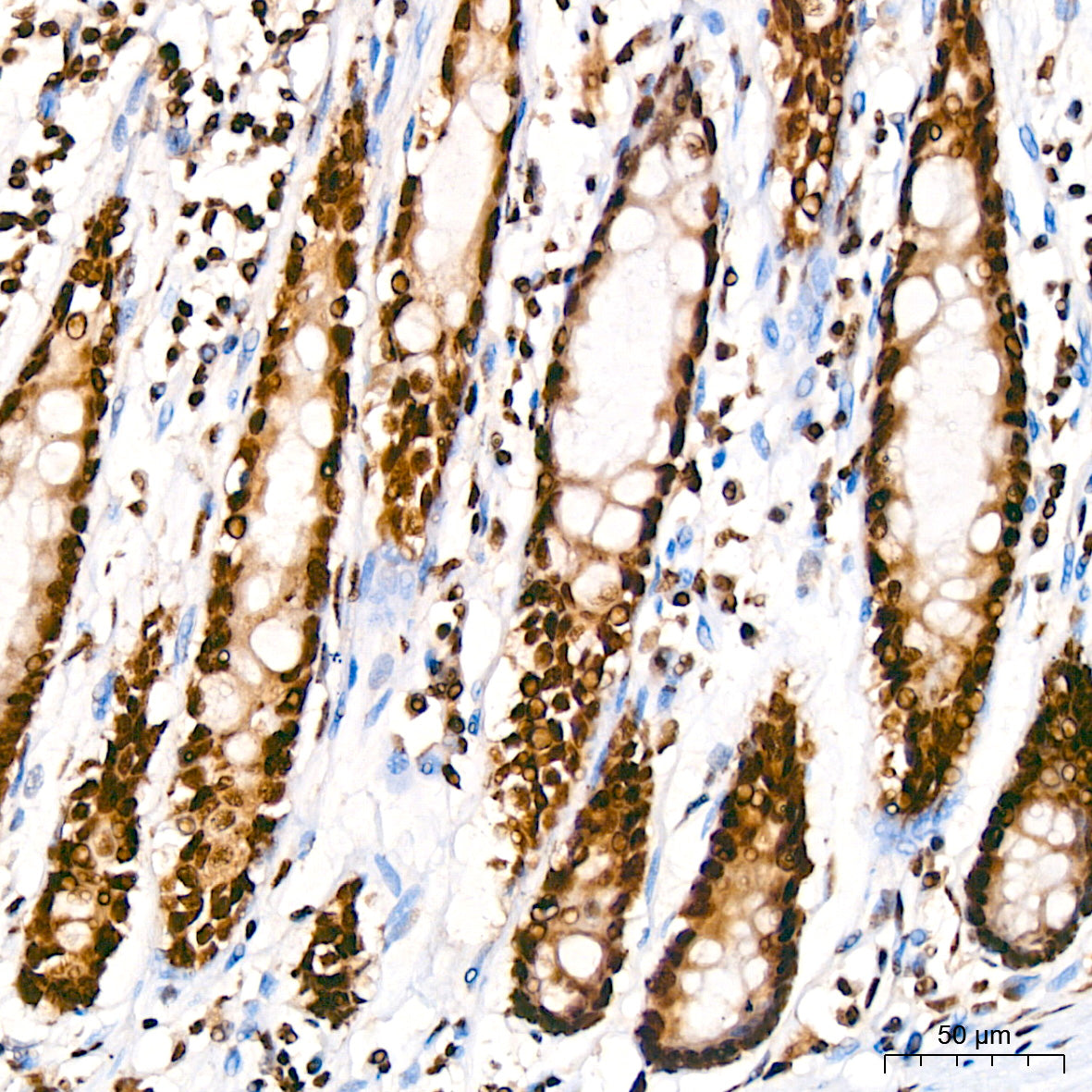 TDP-43/TARDBP Rabbit mAb