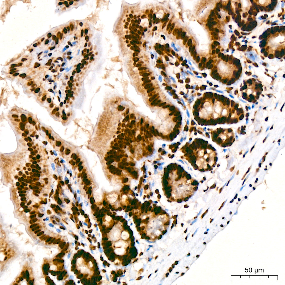 TDP-43/TARDBP Rabbit mAb