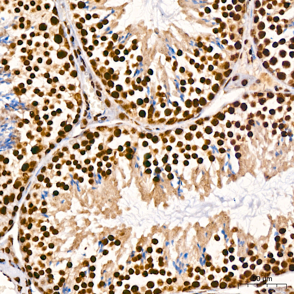 TDP-43/TARDBP Rabbit mAb