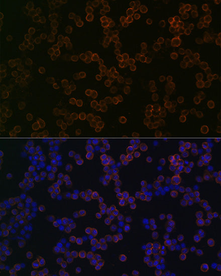 TLR2 Rabbit mAb
