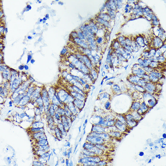 TNFAIP3 Rabbit mAb