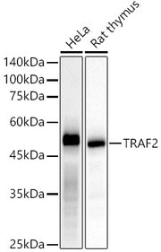 [KD Validated] TRAF2 Rabbit mAb