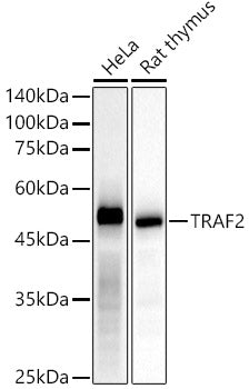 [KD Validated] TRAF2 Rabbit mAb