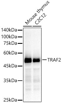 [KD Validated] TRAF2 Rabbit mAb
