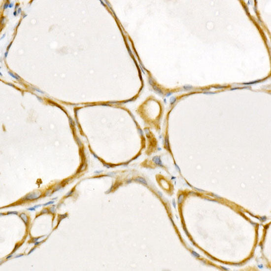 [KD Validated] TRAF2 Rabbit mAb