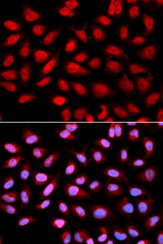 Ser/thr-PP2A activator (PTPA) Rabbit pAb