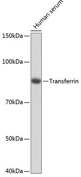 Transferrin Rabbit mAb